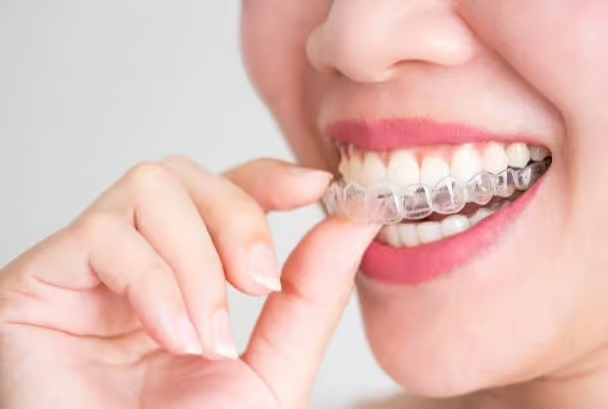 Grandview Dental Clinic | Dental Fillings, Invisalign and Mouthguard