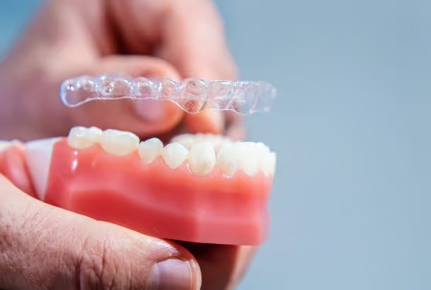 Grandview Dental Clinic | Nightguard, Gum Diseases and Root Canal