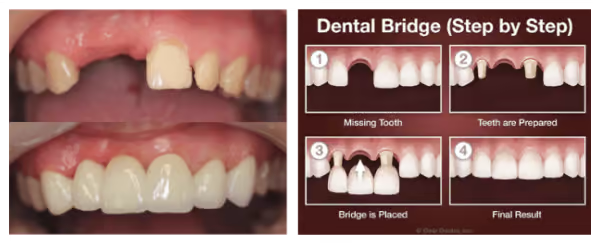 Grandview Dental Clinic | Mouthguard, Dental Fillings and Dental Implants