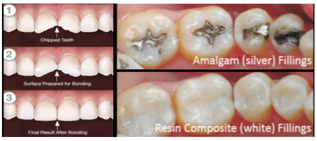 Grandview Dental Clinic | Root Canal, Dental Bridges and Dental Fillings