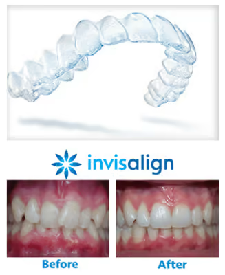 Grandview Dental Clinic | Dental Fillings, Dental Implants and Dentures