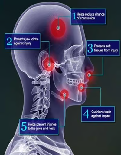 Grandview Dental Clinic | Cosmetic Dentistry, Invisalign Or Clear Aligners and Mouthguard
