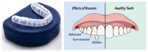 Grandview Dental Clinic | Tooth Extraction, Gum Diseases and Dental Crown