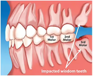 Grandview Dental Clinic | Dental Crown, Dental Bridges and Gum Diseases